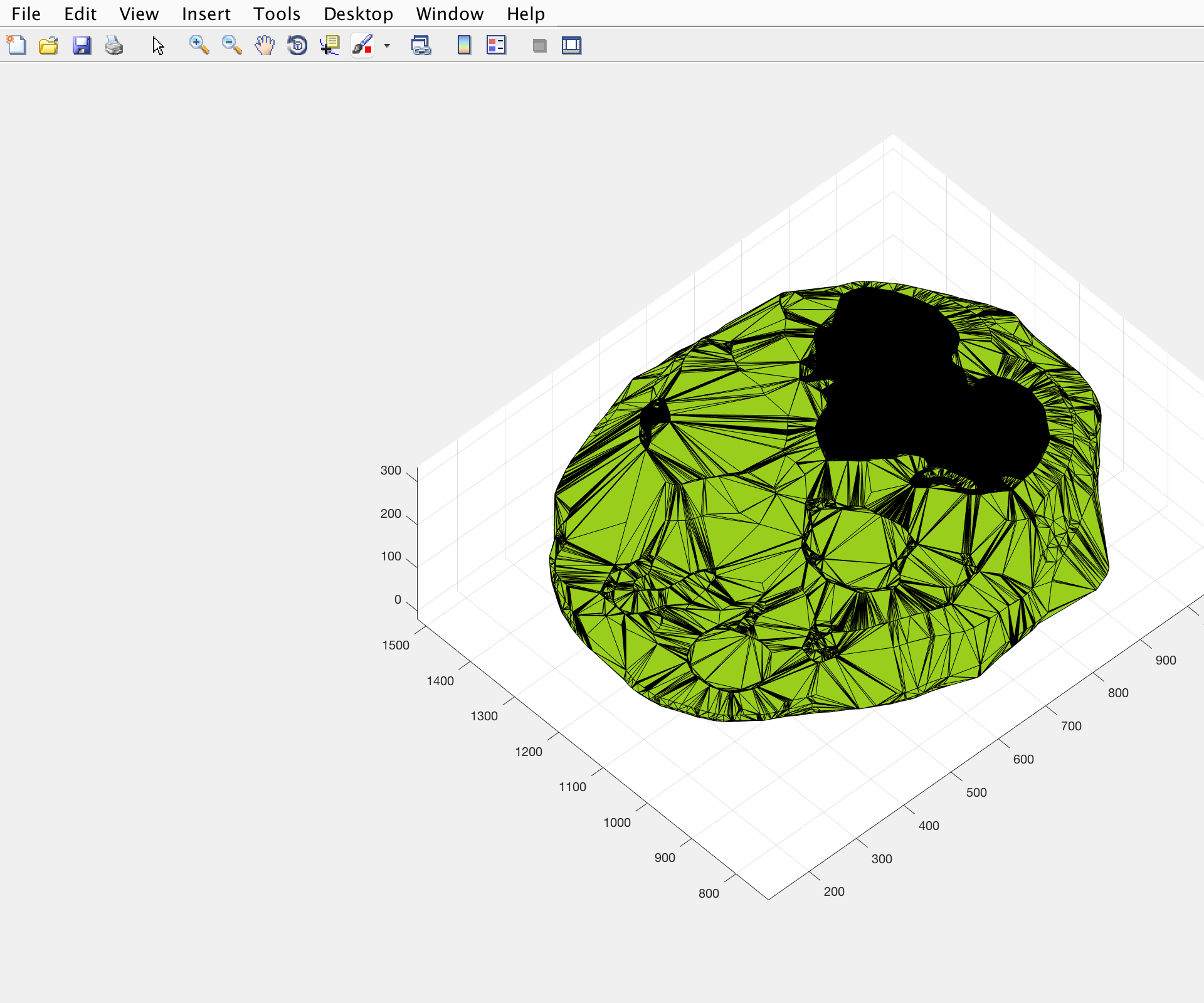 Brain Box: Tracking Neural Volume Over Time 