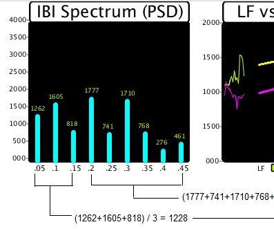 Arduino Pulse Sensor Cardio Graph