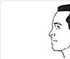 Find Best Cost of Hair Transplant in Delhi