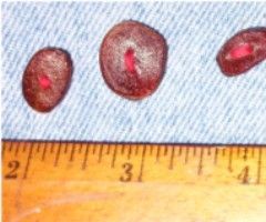 Persimmon seed buttons