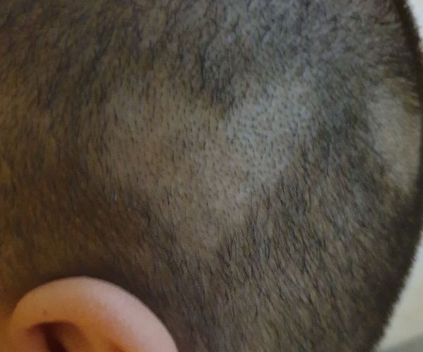 Heart Hair Pattern