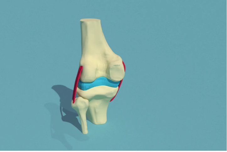 How to Assemble Knee Parts in 3D CAD Software