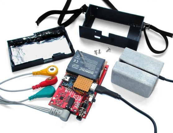 ECG With PPG Using Arduino : 9 Steps (with Pictures) - Instructables