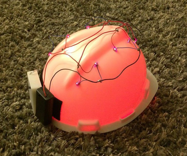 Low Level Laser Therapy (LLLT) Helmet for Hair Regrowth