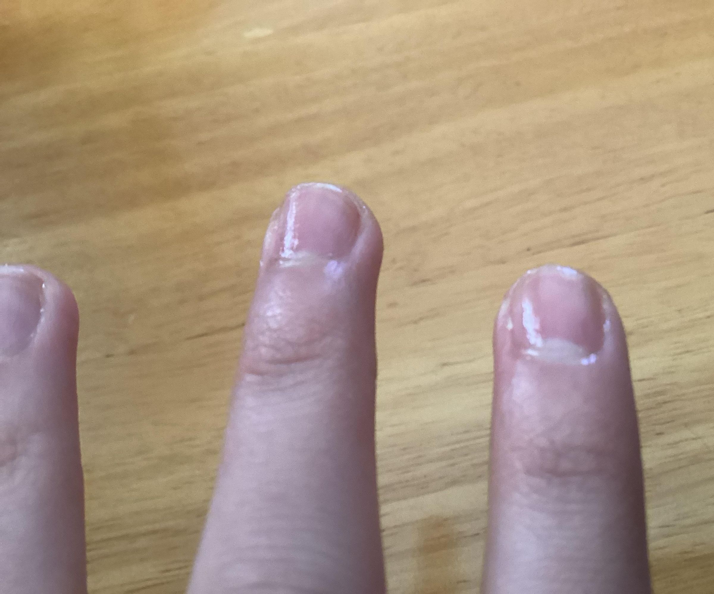 Shiny Nails Without Polish or Buffing
