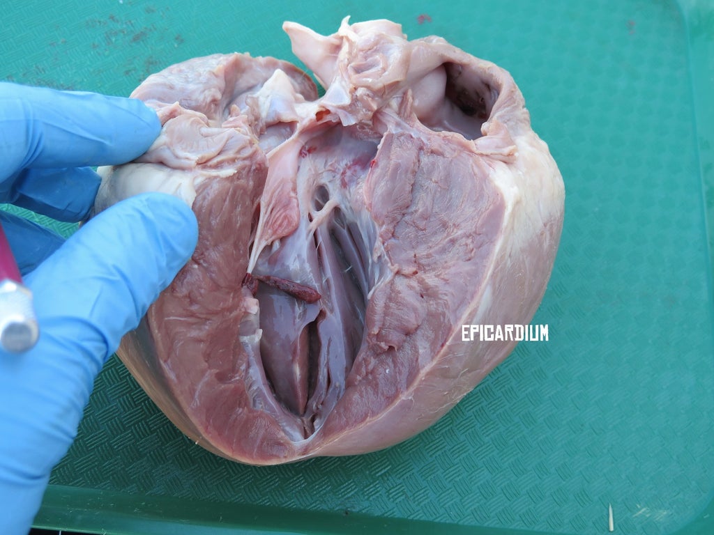 Heart Dissection : 8 Steps (with Pictures) - Instructables