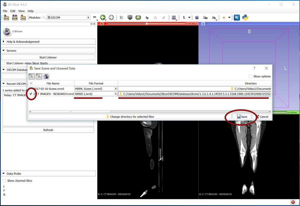 Fre File How to Easily and Automatically Convert a CT Scan (DICOM Data) Into a ...