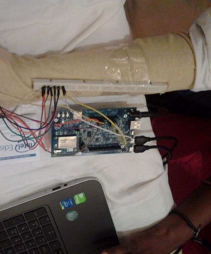 Gesture Calculator(Intel IoT)