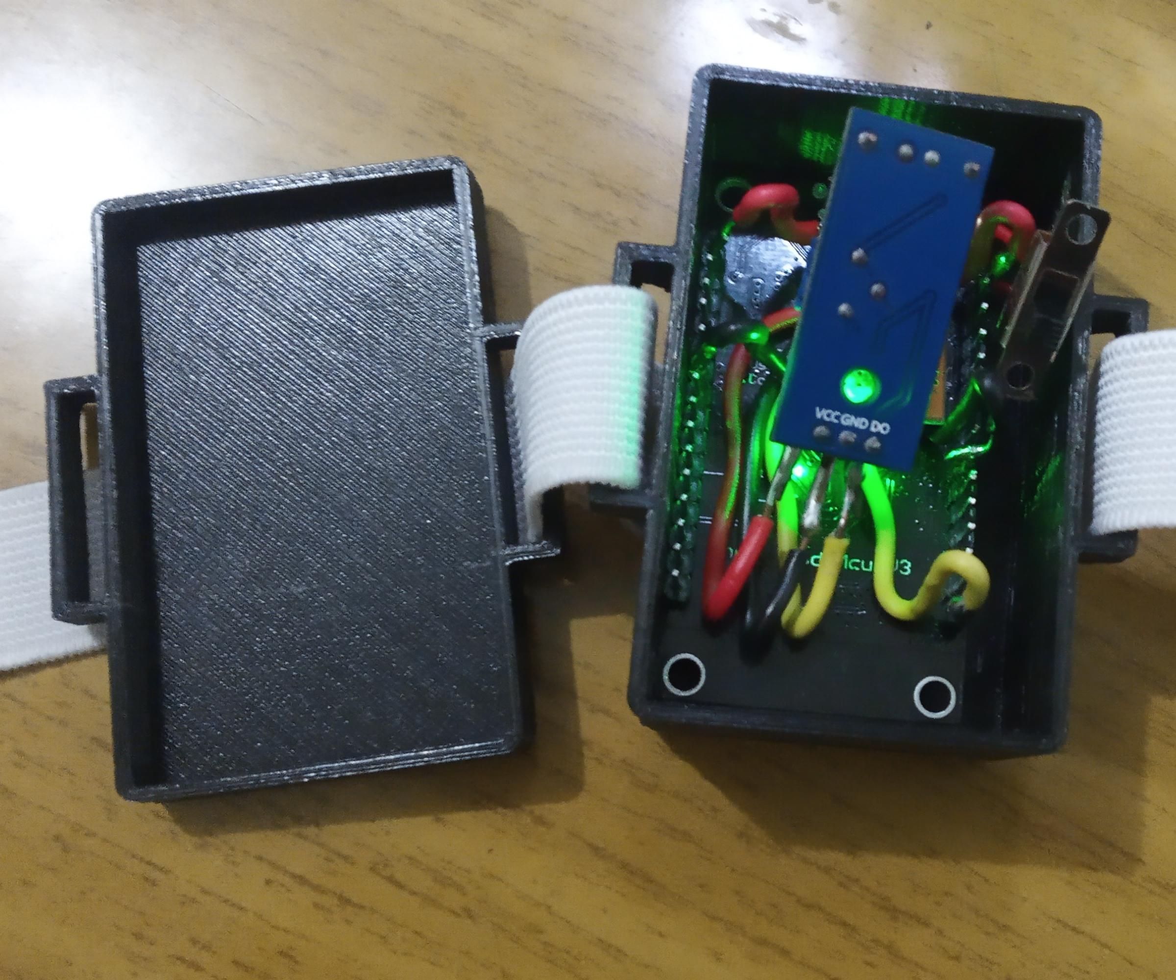 Parkinson Disease Wearable Tech