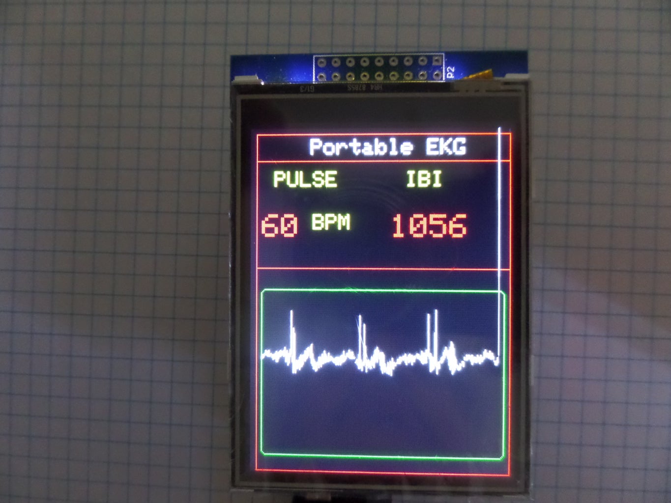 Arduino Portable EKG Monitor