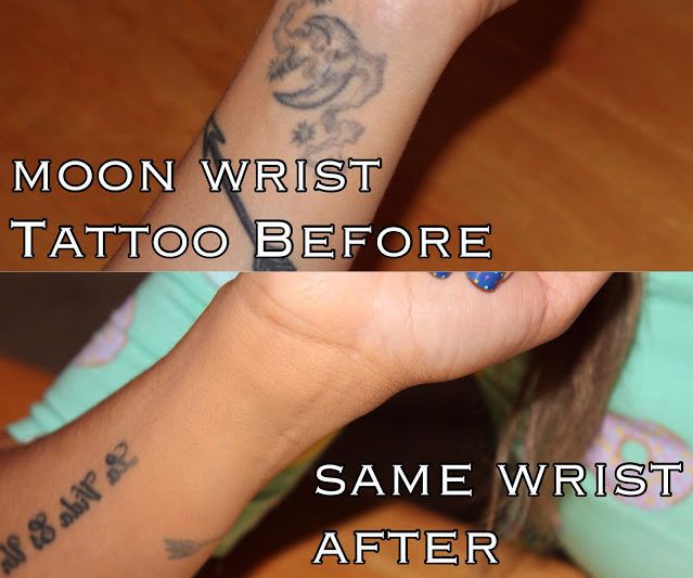 How to Cover a Tattoo