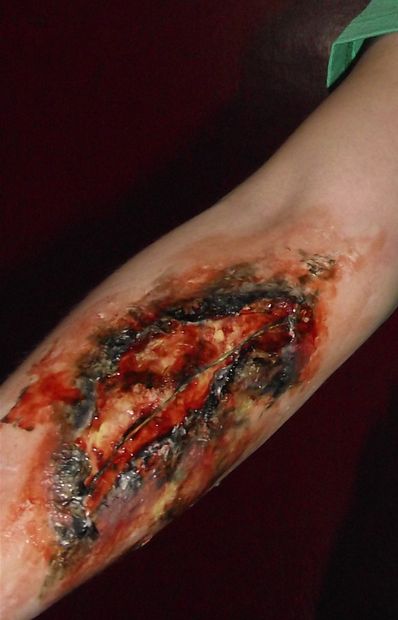 Forum Novelties Two Zombie Prosthetic Bloody Scar Wounds Costume Accessory Forum Novelties Two Zombie Prosthetic Bloody Scar Wounds Costume Accessory