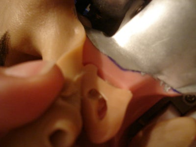 Glueing the Skin Back On