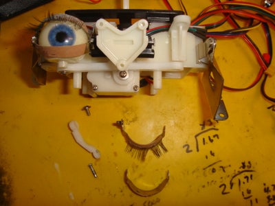 Eye Lid Removal