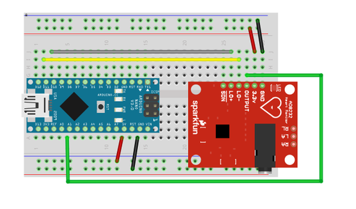 Arduino Based ECG & Heartbeat Monitoring Healthcare System