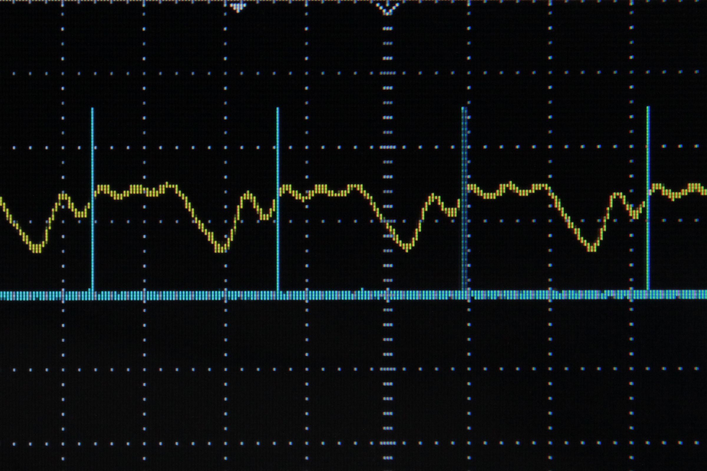Arduino Frequency Detection