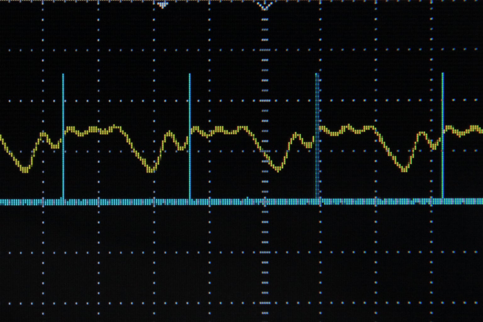 Arduino Frequency Detection : 4 Steps (with Pictures) - Instructables