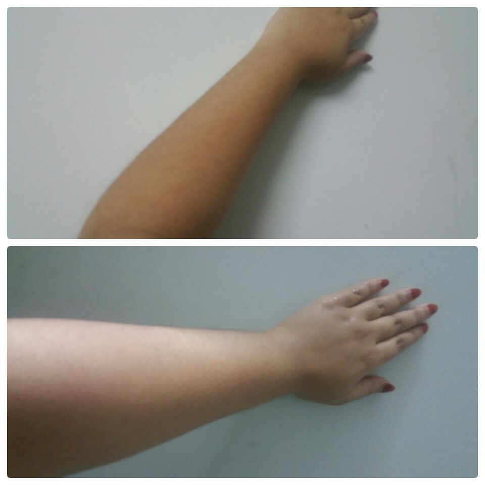 A Home Remedy That Removes Sun Tan