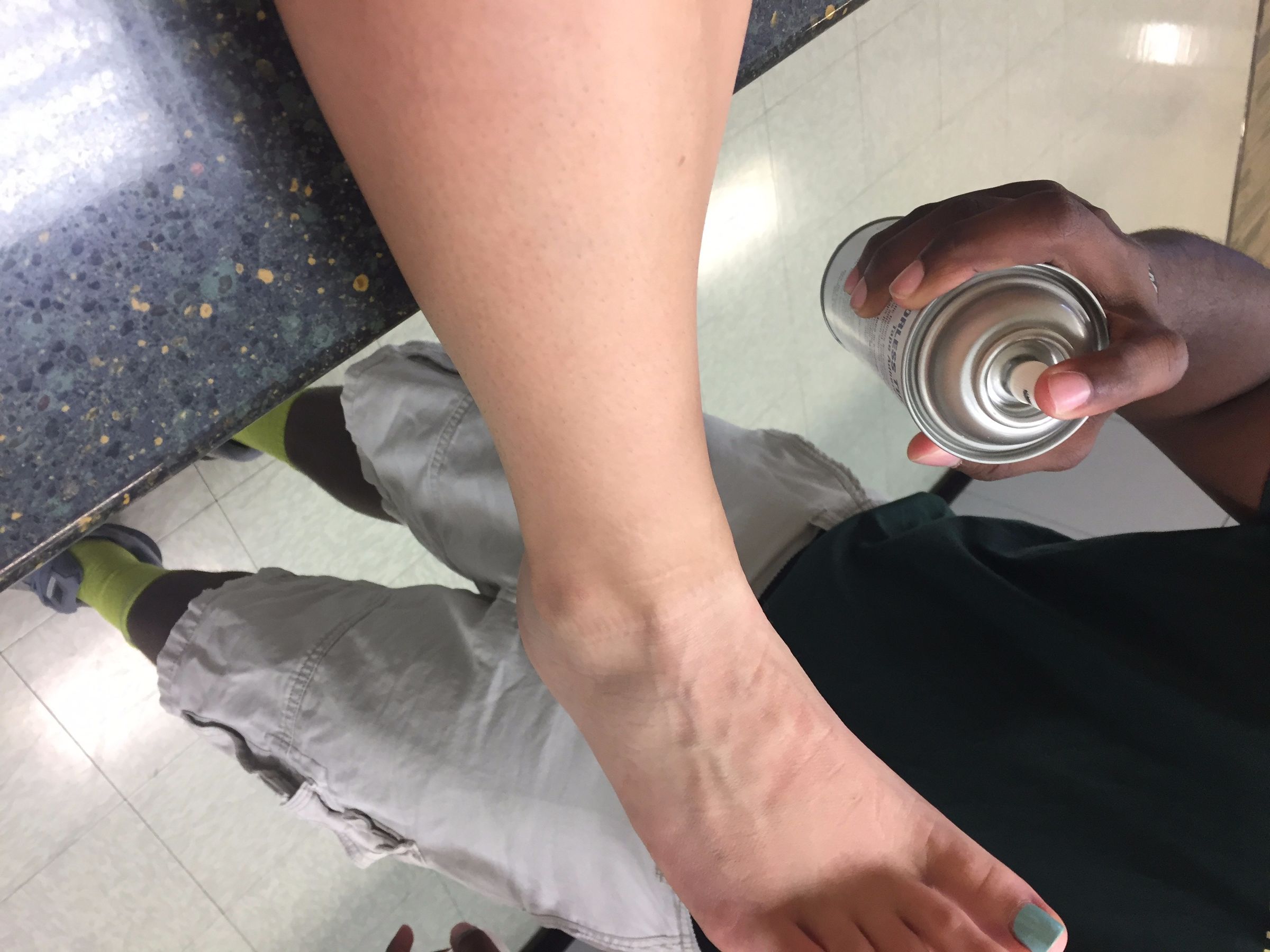 Ankle Taping 8 Steps (with Pictures) Instructables