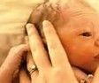 How to Use the Apgar Score to Perform the Initial Assessment of a Neonate Immediately After Birth.