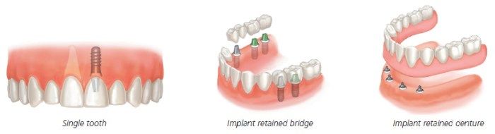 Periodontist Houston - Getting Your Gums in Line