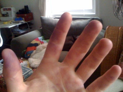 Occupational Hazards...