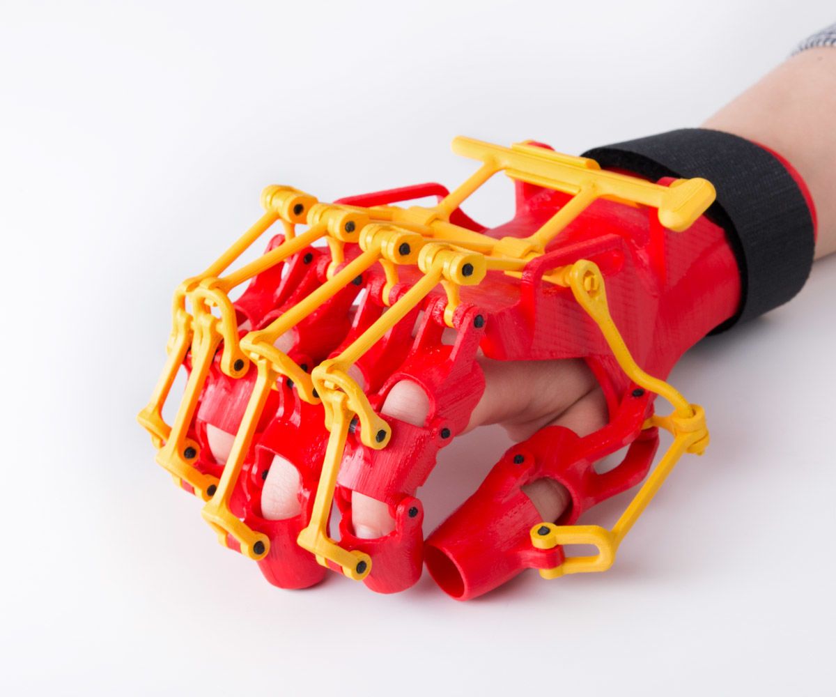 3D Printed Orthosis Prototype (Not for Medical Use!)