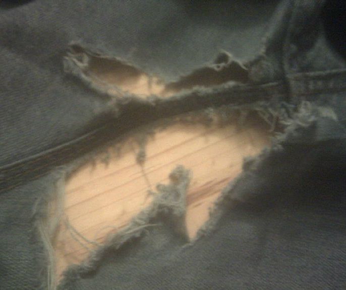 Emergency Seam Repair