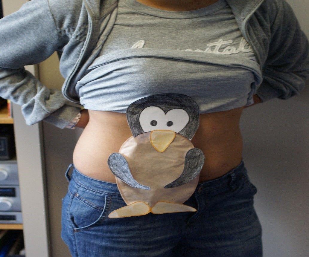 Changing an Ostomy Appliance