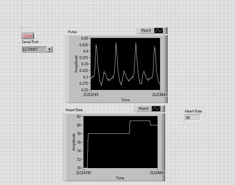 DIY Arduino Pulse Sensor : 10 Steps - Instructables