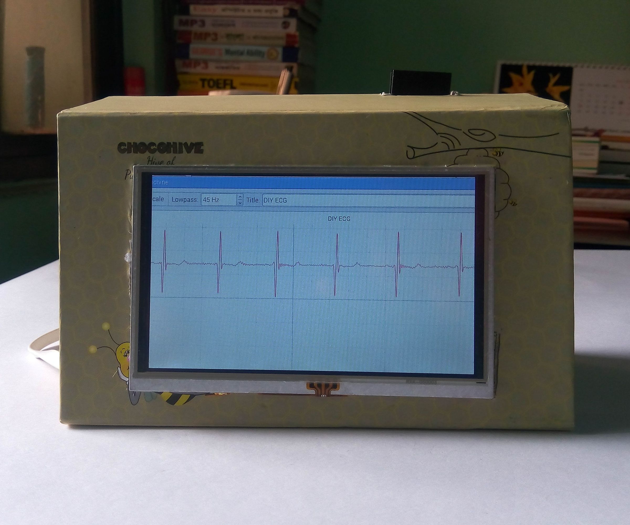 Portable ECG Machine 