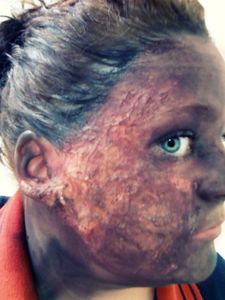 Burnt Face