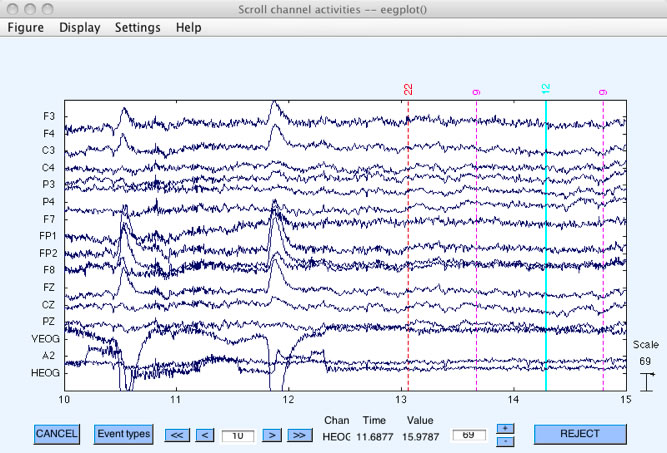 Brain Controlled Music Generator - Submitted by BayLab for the Instructables Sponsorship Program