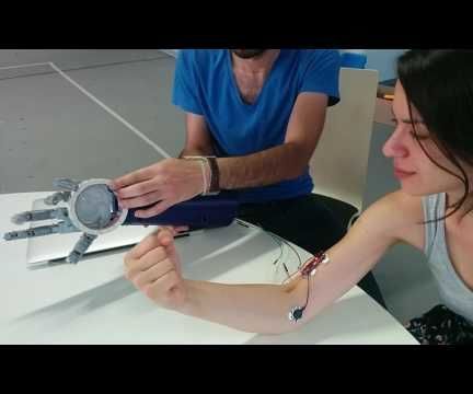 Prosthetic Arm Working With a Myosensor
