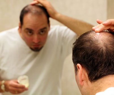 How to Put an End to Baldness