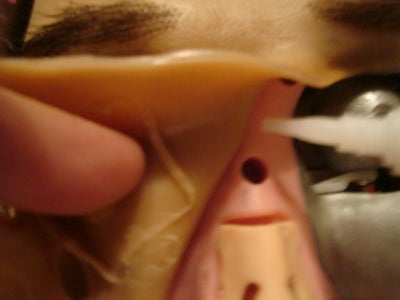 Glueing the Skin Back On