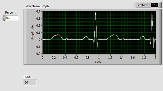 ECG and Heart Rate Virtual User Interface : 9 Steps - Instructables