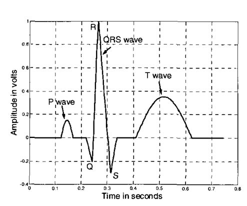 Electrocardiogram (ECG) Circuit