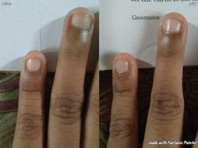 Shiny Nails