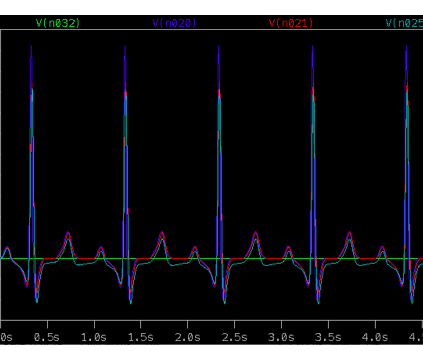 Automated ECG Circuit Simulator