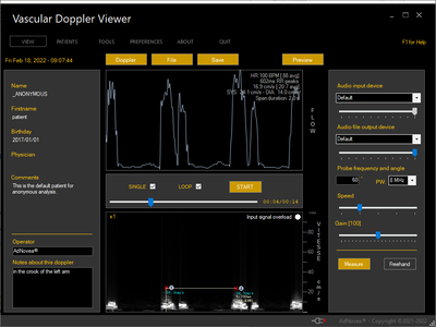 Vascular Doppler Viewer - Low Cost Blood Flow Speed Measure