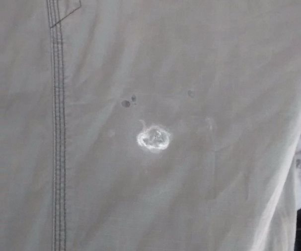 Plan B for 'removing' Super Glue Stain in Clothing