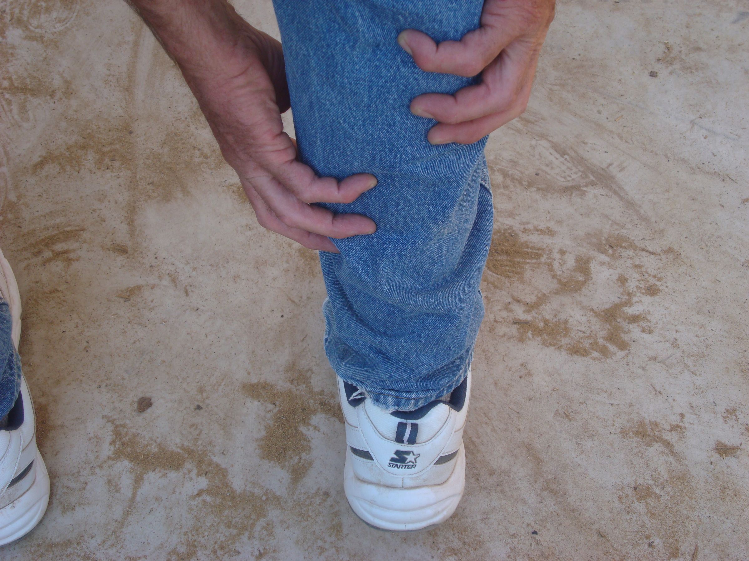 Charley Horse Remedy