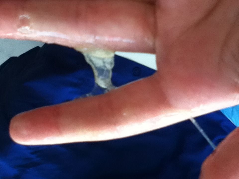 The Awesome Earth Friendly Wound Remedy.