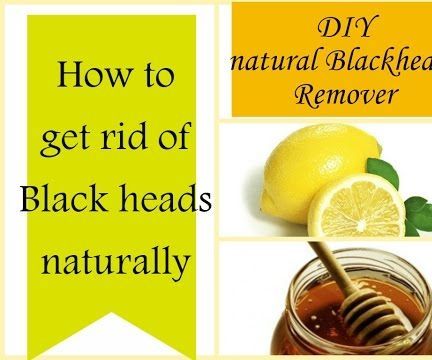 How to Get Rid of Blackheads Naturally I DIY Instant Blackhead Remover I Home Remedies 