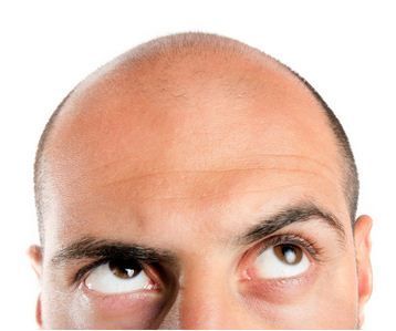 Revolutionary Hair Loss Treatments You May Not Know About