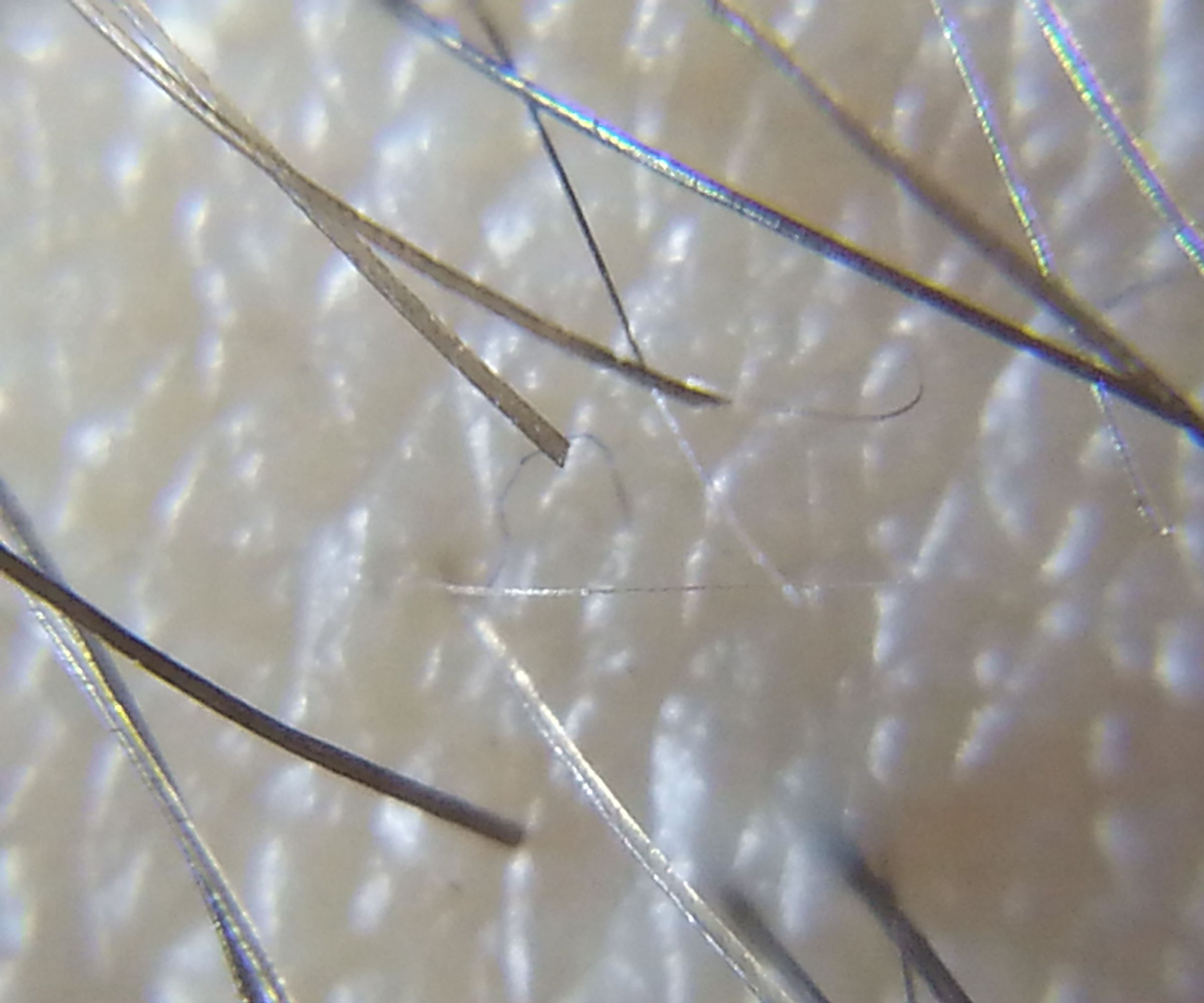 Worlds Easiest Microscope Phone Case