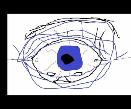 Cyclops Eye