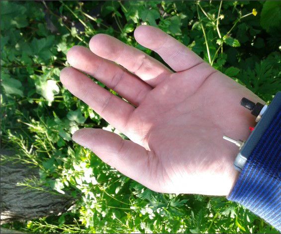 Bob Beck Blood Purifier Casing With Adjustable Electrode Sliders