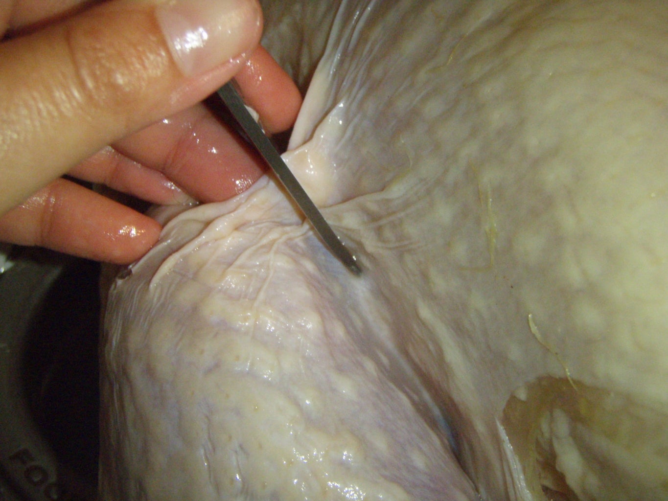 where is the dark meat on a turkey